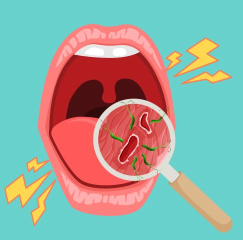 When to worry about those pesky mouth ulcers | Singlife Singapore Article Thumbnail